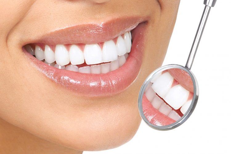 هزینه پالیش دندان چقدر است؟