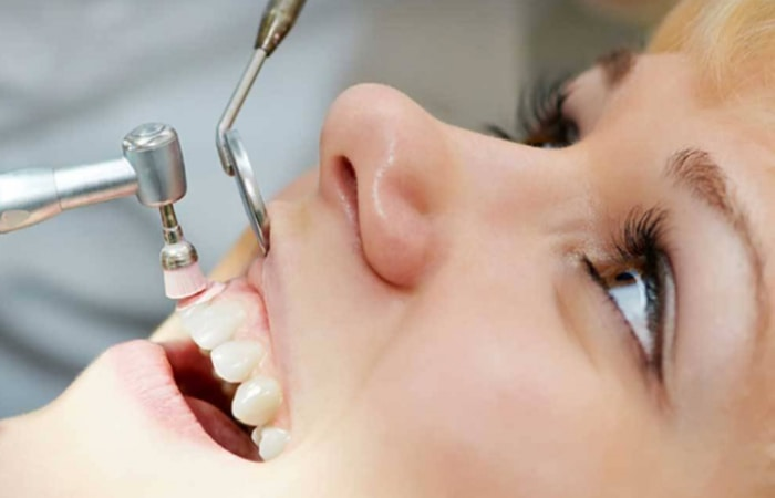 تجزیه و تحلیل هزینه مواد مورد استفاده در ترمیم های پالیش کامپوزیت دندان: