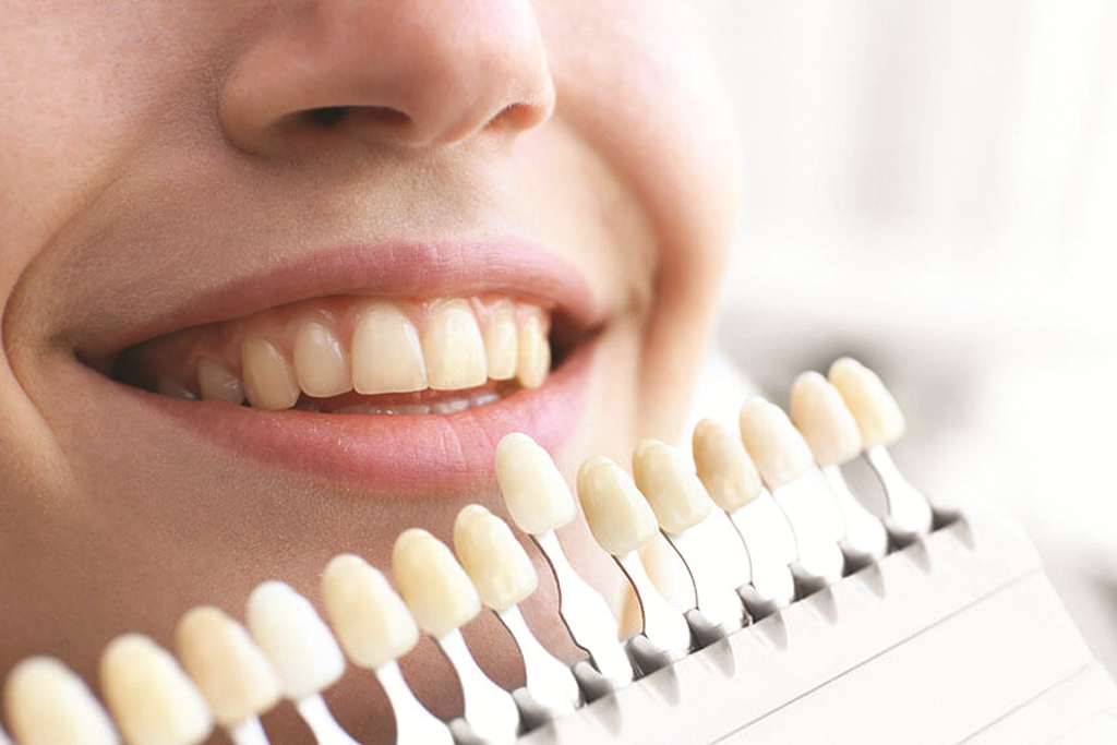 مزایای پالیش دندان بعد از کامپوزیت چیست؟